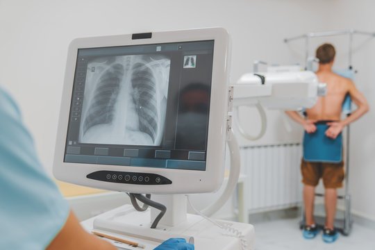 X-Ray Chest – PA View 